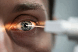 czego nie wolno po laserowej korekcji wzroku